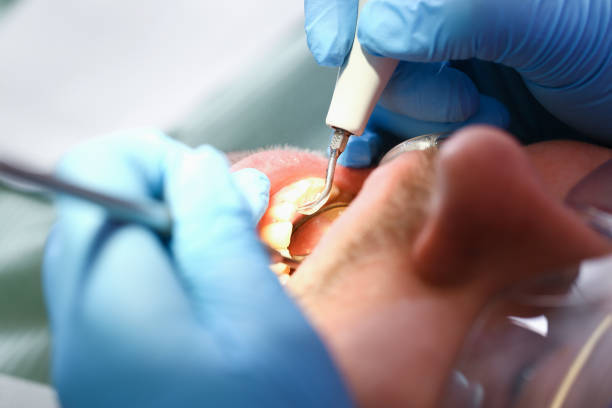 Best Weekend Emergency Dentist in Ashley, OH