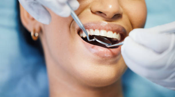 Best Same-Day Emergency Dental Services in Ashley, OH