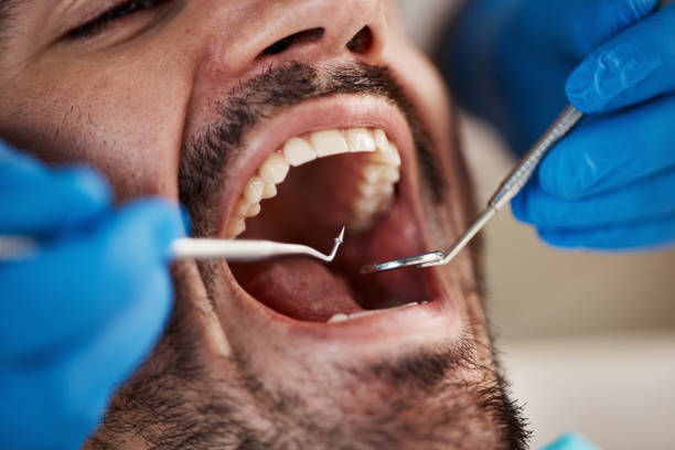 Best Emergency Gum Treatment in Ashley, OH